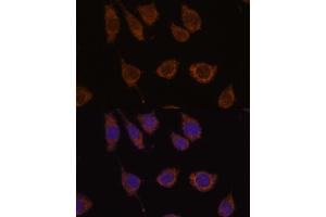 Immunofluorescence analysis of L929 cells using CB antibody (ABIN7266072) at dilution of 1:100. (CA5B antibody  (AA 1-317))