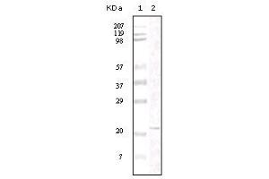 Western blot analysis using FAK mouse mAb against truncated FAK recombinant protein.