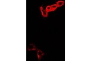 Immunofluorescent analysis of MOCS3 staining in A549 cells. (MOCS3 antibody)