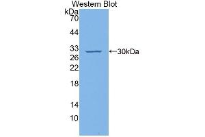 Detection of Recombinant CDKN1B, Human using Polyclonal Antibody to Cyclin Dependent Kinase Inhibitor 1B (CDKN1B) (CDKN1B antibody  (AA 1-198))