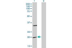 Western Blot analysis of PTPMT1 expression in transfected 293T cell line by PTPMT1 MaxPab polyclonal antibody. (PTPMT1 antibody  (AA 1-201))