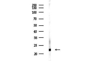 anti-RNA Binding Protein with Multiple Splicing 2 (RBPMS2) antibody