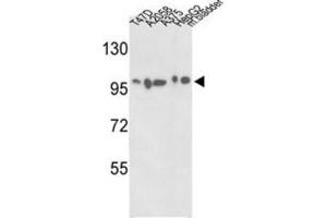 Western Blotting (WB) image for anti-Actinin, alpha 4 (ACTN4) antibody (ABIN3003494)