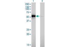 Western Blot analysis of ILK expression in transfected 293T cell line by ILK monoclonal antibody (M01), clone 4F10. (ILK antibody  (AA 341-452))
