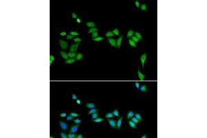 Immunofluorescence analysis of U2OS cells using JADE1 Polyclonal Antibody (PHF17 antibody)