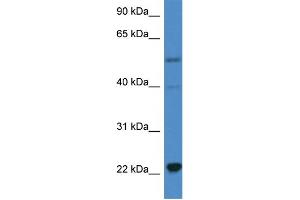 WB Suggested Anti-IL18 AntibodyTitration: 1. (IL-18 antibody  (C-Term))