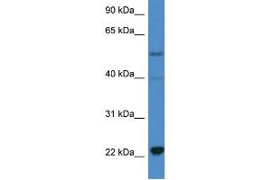 WB Suggested Anti-IL18 AntibodyTitration: 1. (IL-18 antibody  (C-Term))