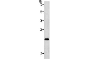 Gel: 12 % SDS-PAGE, Lysate: 40 μg, Lane: Human liver cancer tissue, Primary antibody: ABIN7191632(NEUROG1 Antibody) at dilution 1/400, Secondary antibody: Goat anti rabbit IgG at 1/8000 dilution, Exposure time: 1 minute (Neurogenin 1 antibody)