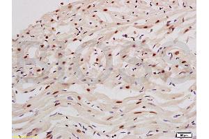 PPARGC1A antibody  (AA 151-250)