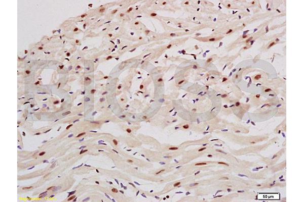 PPARGC1A antibody  (AA 151-250)