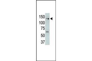 The anti-USP25 N-term Pab (ABIN388917 and ABIN2839196) is used in Western blot to detect USP25 in USP25-transfected HeLa cell lysates. (USP25 antibody  (N-Term))