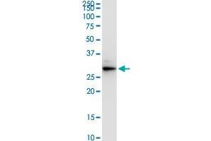 VAPA monoclonal antibody (M01), clone 4C12. (VAPA antibody  (AA 1-242))