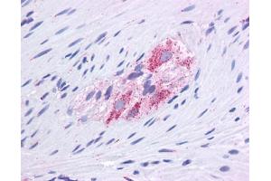GLUD1 antibody was used for immunohistochemistry at a concentration of 4-8 ug/ml.