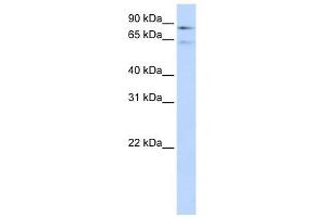 Factor XIII B Polypeptide antibody used at 1 ug/ml to detect target protein. (F13B antibody  (Middle Region))