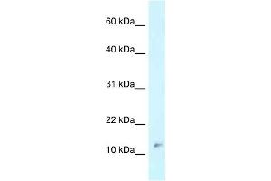 Western Blot showing RPL37 antibody used at a concentration of 1 ug/ml against MCF7 Cell Lysate (RPL37 antibody  (Middle Region))