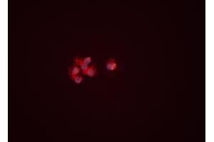ABIN6261535 and ABIN6276460 staining HEPG2 cells by ICC/IF. (ENO1 antibody  (C-Term))