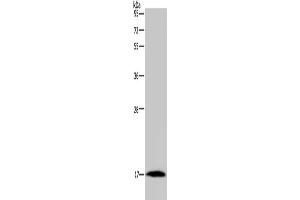 Gel: 10 % SDS-PAGE, Lysate: 40 μg, Lane: Mouse heart tissue, Primary antibody: ABIN7191408(MARVELD1 Antibody) at dilution 1/300, Secondary antibody: Goat anti rabbit IgG at 1/8000 dilution, Exposure time: 10 minutes (MARVELD1 antibody)