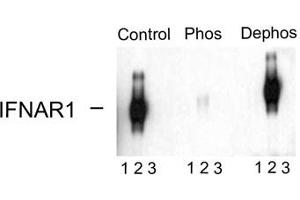 Image no. 2 for anti-Interferon alpha/beta Receptor 1 (IFNAR1) (pSer535), (Ser539) antibody (ABIN228236) (IFNAR1 antibody  (pSer535, Ser539))