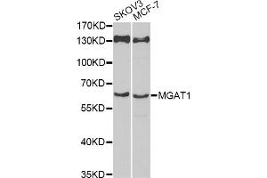 Western blot analysis of extracts of various cell lines, using MGAT1 antibody (ABIN6293367) at 1:1000 dilution.