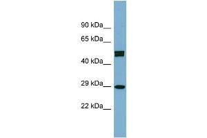 WB Suggested Anti-HOXC8 Antibody Titration: 0. (HOXC8 antibody  (Middle Region))