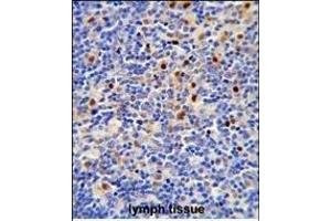 Formalin-fixed and paraffin-embedded human lymph tissue reacted with LTA4H Antibody (Center) (ABIN650745 and ABIN2839464) , which was peroxidase-conjugated to the secondary antibody, followed by DAB staining. (LTA4H antibody  (AA 163-191))