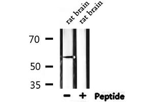 Western Blotting (WB) image for anti-Zinc Finger and SCAN Domain Containing 22 (ZSCAN22) (Internal Region) antibody (ABIN6259484)