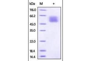 SDS-PAGE (SDS) image for Interleukin 13 Receptor, alpha 1 (IL13RA1) (AA 26-340) protein (His tag) (ABIN2181339)