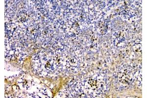 IHC analysis of GM130 using anti-GM130 antibody (ABIN6719433). (Golgin A2 (GOLGA2) (AA 796-913) antibody)