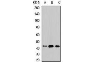 Western blot analysis of Malin expression in mouse brain (A), mouse heart (B), rat liver (C) whole cell lysates. (NHLRC1 antibody)