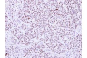 IHC-P Image Immunohistochemical analysis of paraffin-embedded SW480 xenograft, using RCC2, antibody at 1:500 dilution. (RCC2 antibody)
