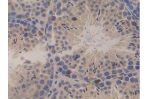 DAB staining on IHC-P; Samples: Mouse Testis Tissue (SSFA2 antibody  (AA 587-802))