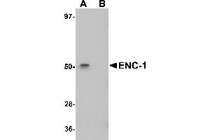Western Blotting (WB) image for anti-Ectodermal-Neural Cortex 1 (With BTB-Like Domain) (ENC1) (Middle Region) antibody (ABIN1030924) (ENC1 antibody  (Middle Region))