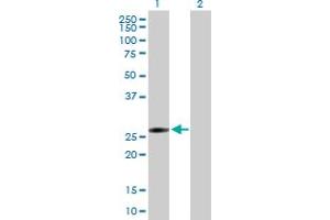 Western Blot analysis of FLJ40504 expression in transfected 293T cell line by FLJ40504 MaxPab polyclonal antibody. (KRT18P55 antibody  (AA 1-259))
