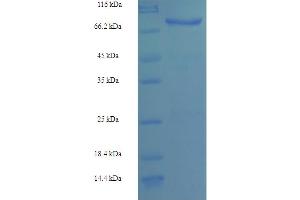 SDS-PAGE (SDS) image for CCCTC-Binding Factor (Zinc Finger Protein)-Like (CTCFL) (AA 1-636), (full length) protein (His-SUMO Tag) (ABIN5709351) (CTCFL Protein (AA 1-636, full length) (His-SUMO Tag))
