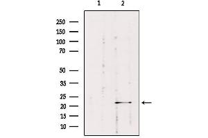 Western blot analysis of extracts from HepG2, using RAB1B Antibody. (RAB1B antibody  (Internal Region))