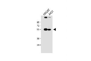 All lanes : Anti-SG Antibody (N-term) at 1:1000 dilution Lane 1: HACAT whole cell lysate Lane 2: A431 whole cell lysate Lysates/proteins at 20 μg per lane. (SGPP1 antibody  (N-Term))