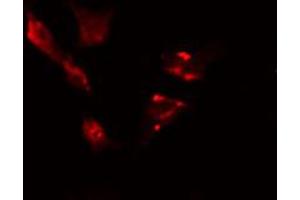 ABIN6274422 staining HeLa cells by IF/ICC. (TBC1D3 antibody)