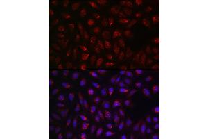 Immunofluorescence analysis of U2OS cells using SDHA Rabbit pAb (ABIN3023399, ABIN3023400, ABIN3023401, ABIN1682638 and ABIN6219706) at dilution of 1:100 (40x lens). (SDHA antibody  (AA 385-664))