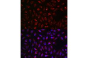 Immunofluorescence analysis of U2OS cells using SDHA Rabbit pAb (ABIN3023399, ABIN3023400, ABIN3023401, ABIN1682638 and ABIN6219706) at dilution of 1:100 (40x lens). (SDHA antibody  (AA 385-664))