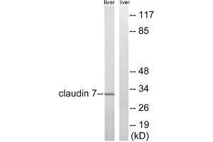Western blot analysis of extracts from rat liver cells, using Claudin 7 (epitope around residue 210) antibody. (Claudin 7 antibody  (Tyr210))