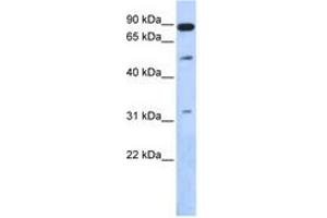Image no. 1 for anti-SUMO1/sentrin Specific Peptidase 5 (SENP5) (AA 503-552) antibody (ABIN6743841) (SENP5 antibody  (AA 503-552))