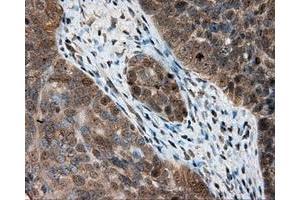 Immunohistochemical staining of paraffin-embedded Kidney tissue using anti-PTPRE mouse monoclonal antibody. (PTPRE antibody)