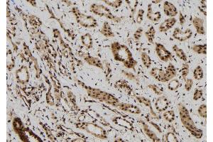 ABIN6272513 at 1/100 staining Human kidney tissue by IHC-P. (MAGEB6 antibody  (Internal Region))