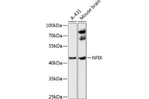 Western blot analysis of extracts of various cell lines, using NFIX antibody (ABIN6129696, ABIN6144568, ABIN6144569 and ABIN6224994) at 1:3000 dilution. (NFIX antibody  (AA 180-260))