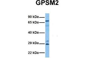 Host:  Rabbit  Target Name:  GPSM2  Sample Tissue:  Human Lung Tumor  Antibody Dilution:  1. (GPSM2 antibody  (N-Term))