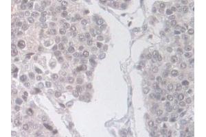 Immunohistochemistry (IHC) image for anti-Phospholipase D (PLD) (AA 725-1074) antibody (ABIN7434611)