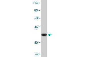 Western Blot detection against Immunogen (36. (PYGO1 antibody  (AA 101-200))