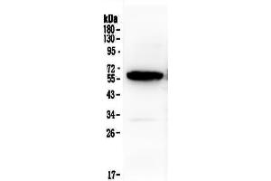 Western blot analysis of Syndecan-1/SDC1 using anti-Syndecan-1/SDC1 antibody .