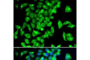 Immunofluorescence analysis of A549 cells using TPH2 Polyclonal Antibody