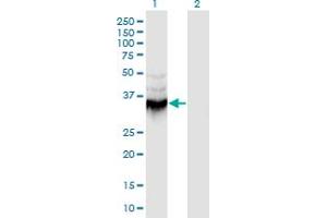 Western Blot analysis of ANXA9 expression in transfected 293T cell line by ANXA9 monoclonal antibody (M08), clone 5G3. (Annexin A9 antibody  (AA 1-338))